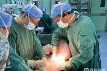 四个月未解大便，男子腹中掏出2米“巨蟒”结肠
