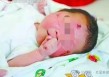 厦门车祸“奇迹宝宝”近况：在泸州老家生活，亲属因赔偿款反目